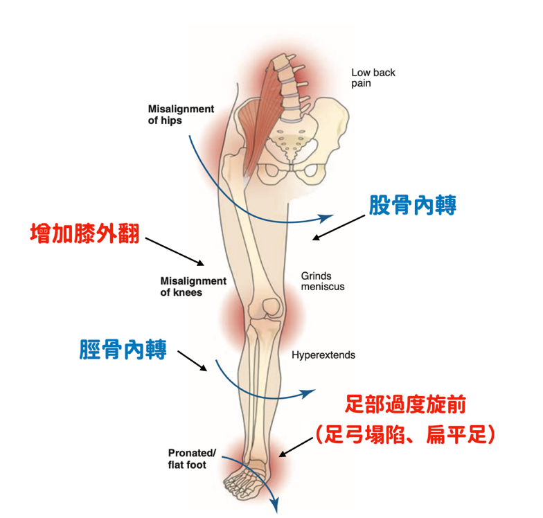 下肢運動障礙症候群-Lumbo-pelvic-hip complex, LPHC