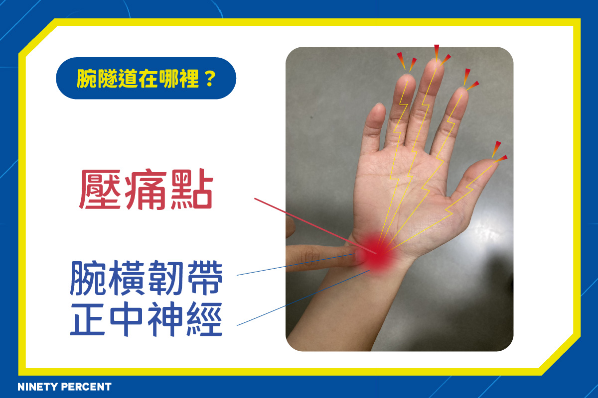 腕隧道症候群-手腕痛