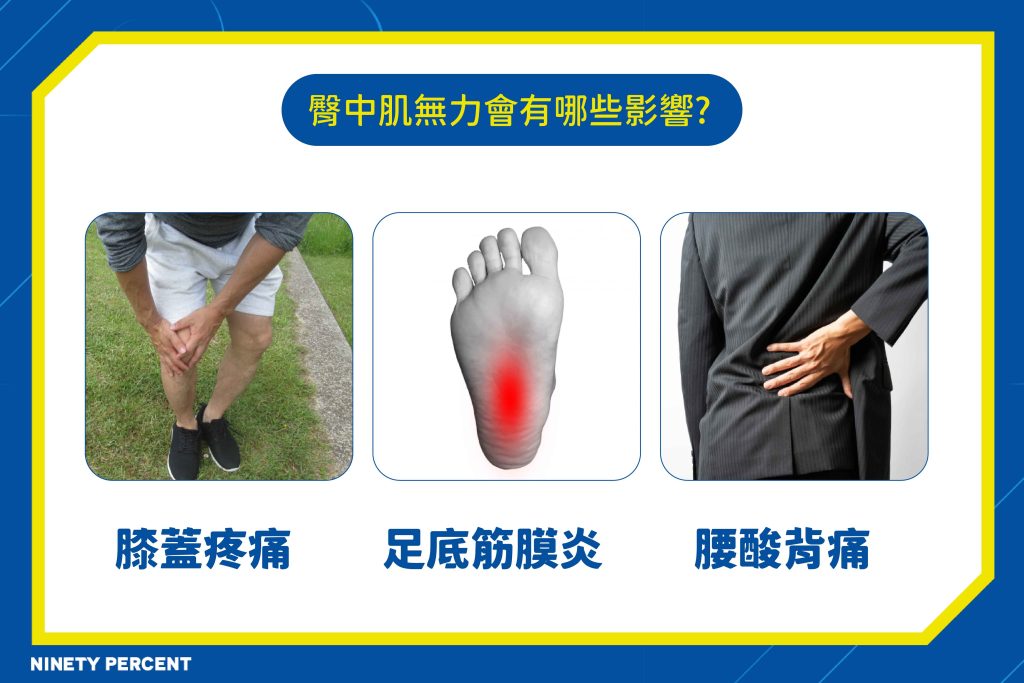 臀中肌無力影響-膝蓋痛-足底筋膜炎-腰酸背痛-臀中肌