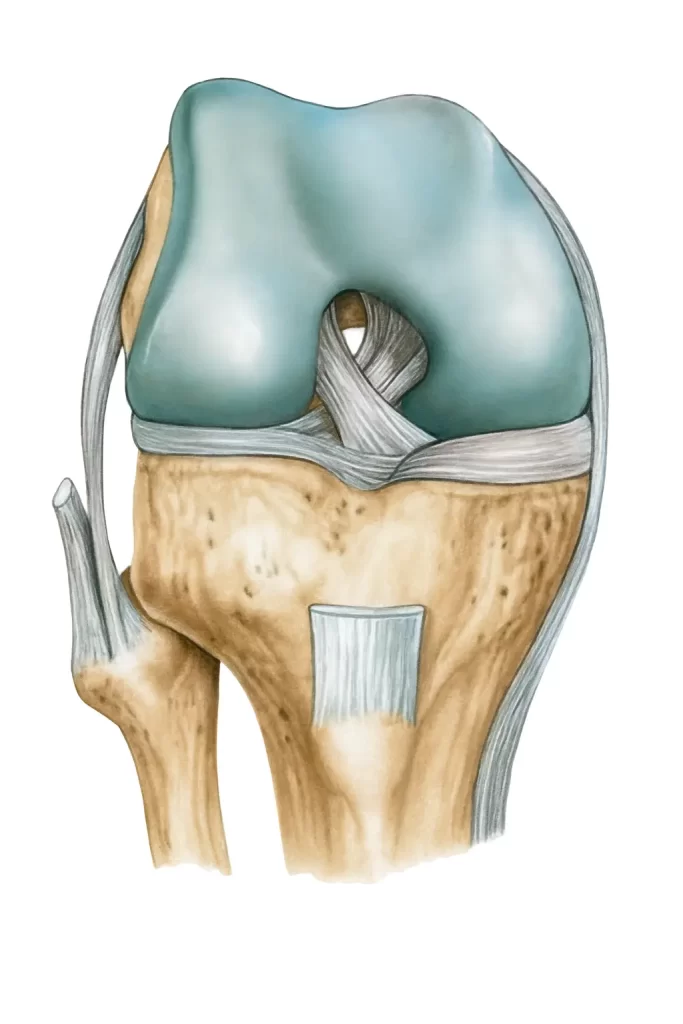十字韌帶,十字韌帶斷裂,十字韌帶手傷,十字韌帶手術,ACL